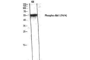 Western Blotting (WB) image for anti-V-Akt Murine Thymoma Viral Oncogene Homolog 1 (AKT1) (pTyr474) antibody (ABIN6283968) (AKT1 anticorps  (pTyr474))