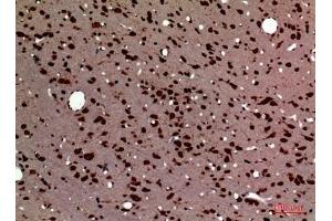 Immunohistochemical analysis of paraffin-embedded rat-brain, antibody was diluted at 1:100. (Pleiotrophin anticorps  (Internal Region))