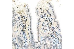 Immunohistochemistry analysis of paraffin-embedded mouse colon using,EEA1 (ABIN7073795) at dilution of 1: 2500 (EEA1 anticorps)