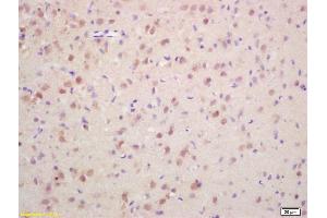 Formalin-fixed and paraffin embedded rat brain labeled with Rabbit Anti Phospho-Histone H3 (Ser10) Polyclonal Antibody, Unconjugated (ABIN742553) at 1:200 followed by conjugation to the secondary antibody and DAB staining (Histone 3 anticorps  (pSer11))