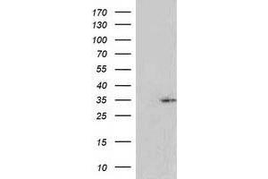 HEK293T cells were transfected with the pCMV6-ENTRY control (Left lane) or pCMV6-ENTRY RASSF5 (Right lane) cDNA for 48 hrs and lysed. (RASSF5 anticorps)