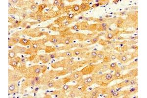 Immunohistochemistry of paraffin-embedded human liver tissue using ABIN7149206 at dilution of 1:100 (CYP1A2 anticorps  (AA 268-445))