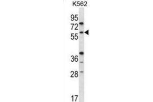 Western Blotting (WB) image for anti-Recombination Activating Gene 2 (RAG2) antibody (ABIN2996750) (RAG2 anticorps)