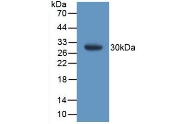 GSTT1 anticorps  (AA 7-240)