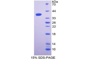 SDS-PAGE analysis of Rat Complement Component 3 Protein. (C3 Protéine)