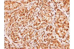 IHC-P Image Immunohistochemical analysis of paraffin-embedded A549 xenograft, using MID1IP1, antibody at 1:100 dilution. (m1ip1 anticorps)