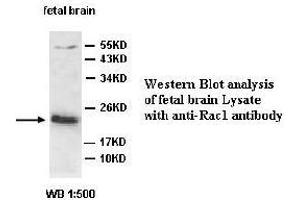 Image no. 2 for anti-RAC1 antibody (ABIN791257) (RAC1 anticorps)