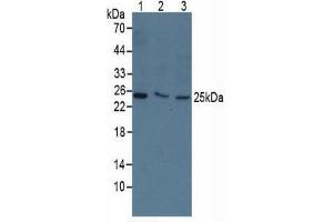 Rabbit Detection antibody from the kit in WB with Positive Control: Sample Human 293T cells. (TK1 Kit ELISA)