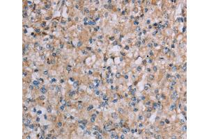 Immunohistochemistry (IHC) image for anti-Plexin A4 (PLXNA4) antibody (ABIN2435214) (Plexin A4 anticorps)