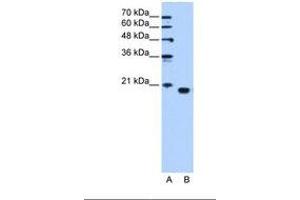 Image no. 1 for anti-Phosphatidylethanolamine Binding Protein 1 (PEBP1) (C-Term) antibody (ABIN321403) (PEBP1 anticorps  (C-Term))