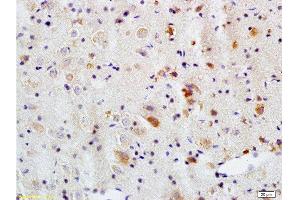 Immunohistochemistry (Paraffin-embedded Sections) (IHC (p)) image for anti-ATG5 Autophagy Related 5 (ATG5) (AA 101-200) antibody (ABIN752413)