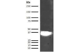 Western Blotting (WB) image for anti-Annexin A5 (ANXA5) (AA 1-320) antibody (ABIN5564834) (Annexin V anticorps  (AA 1-320))