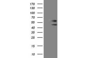 Western Blotting (WB) image for anti-Chromosome 9 Open Reading Frame 41 (C9orf41) antibody (ABIN1497061) (C9orf41 anticorps)