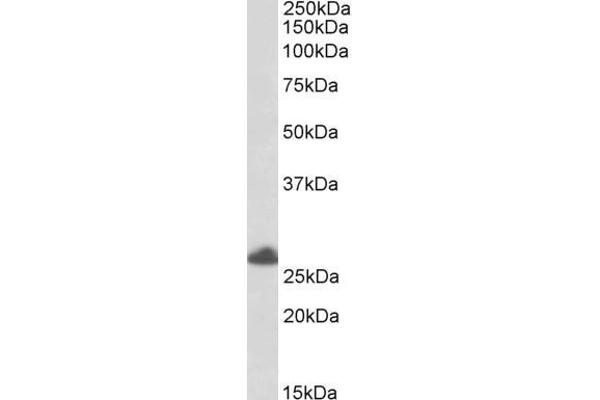 TRIM40 anticorps  (C-Term)