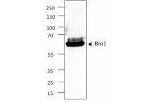 Western Blotting (WB) image for anti-Bridging Integrator 1 (BIN1) antibody (ABIN2664071) (BIN1 anticorps)