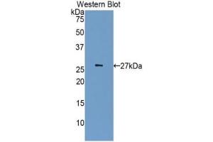 Detection of Recombinant CDK5, Human using Polyclonal Antibody to Cyclin Dependent Kinase 5 (CDK5) (CDK5 anticorps  (AA 92-273))