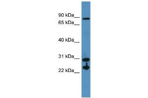Western Blotting (WB) image for anti-Carbonic Anhydrase II (CA2) (N-Term) antibody (ABIN617260) (CA2 anticorps  (N-Term))