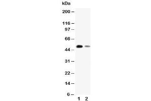 Western blot testing of KLF8 antibody and Lane 1:  SMMC-7721 (KLF8 anticorps  (N-Term))