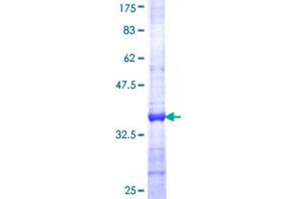 S100A5 Protein (AA 1-90) (GST tag)