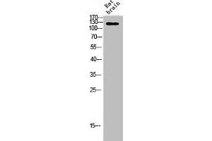 Western Blot analysis of RAT-BRAIN cells using Ataxin-2 Polyclonal Antibody (Ataxin 2 anticorps  (Internal Region))