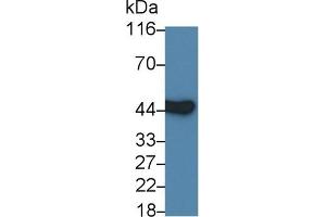 Detection of IL3Ra in MCF7 cell lysate using Polyclonal Antibody to Interleukin 3 Receptor Alpha (IL3Ra) (IL3RA anticorps  (AA 17-166))
