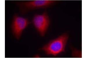 Image no. 2 for anti-Protein Kinase C, theta (PRKCQ) (AA 674-678) antibody (ABIN197567) (PKC theta anticorps  (AA 674-678))