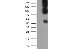 HEK293T cells were transfected with the pCMV6-ENTRY control (Left lane) or pCMV6-ENTRY CD80 (Right lane) cDNA for 48 hrs and lysed. (CD80 anticorps)