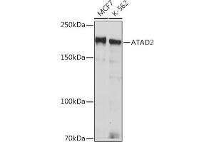 Western blot analysis of extracts of various cell lines, using  Rabbit mAb (ABIN7265749) at 1:1000 dilution. (ATAD2 anticorps)