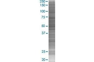 NPPB transfected lysate. (NPPB 293T Cell Transient Overexpression Lysate(Denatured))