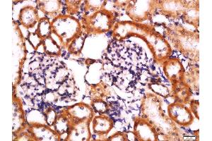 Immunohistochemistry (Paraffin-embedded Sections) (IHC (p)) image for anti-NLR Family, Pyrin Domain Containing 3 (NLRP3) (AA 15-120) antibody (ABIN1386361)