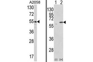 (LEFT) Western blot analysis of PDIA3 Antibody (C-term) in A2058 cell line lysates (35ug/lane). (PDIA3 anticorps  (C-Term))