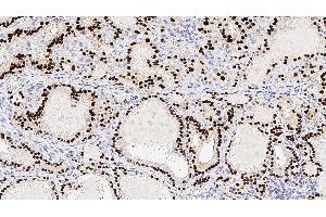 Human thyroid: immunohistochemical staining for Thyroid Transcription Factor-1. (NKX2-1 anticorps  (N-Term))