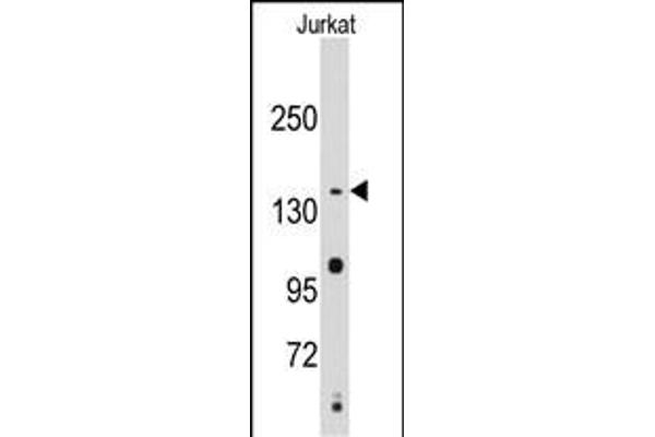 SMC2 anticorps  (C-Term)