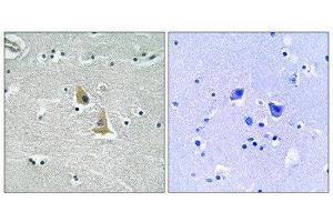 Immunohistochemistry (IHC) image for anti-Neutrophil Cytosol Factor 1 (NCF1) (Ser345) antibody (ABIN1848361) (NCF1 anticorps  (Ser345))