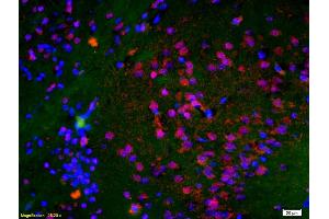 Formalin-fixed and paraffin embedded rat brain labeled with Anti-Histone H3 (Di Methyl K9) Polyclonal Antibody, Unconjugated (ABIN703886) at 1:200 followed by conjugation to the secondary antibody Goat Anti-Rabbit IgG, Cy3 conjugated used at 1:200 dilution for 40 minutes at 37 °C and DAPI staining (Histone 3 anticorps  (H3K9me))