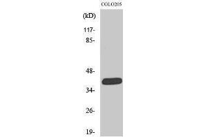 Western Blotting (WB) image for anti-Solute Carrier Family 22 Member 18 (SLC22A18) (C-Term) antibody (ABIN3176679) (ORCTL-2/SLC22A18 anticorps  (C-Term))