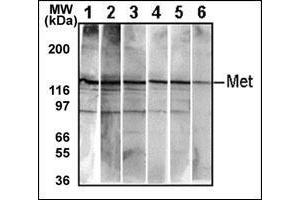 Western Blotting (WB) image for anti-Met Proto-Oncogene (MET) (Catalytic Domain) antibody (ABIN356341) (c-MET anticorps  (Catalytic Domain))