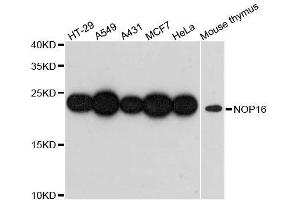 Western blot analysis of extracts of various cell lines, using NOP16 antibody. (NOP16 anticorps  (AA 1-178))