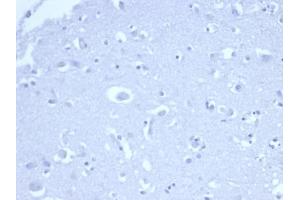 IHC analysis of formalin-fixed, paraffin-embedded human brain. (Recombinant p21 anticorps  (AA 1-100))