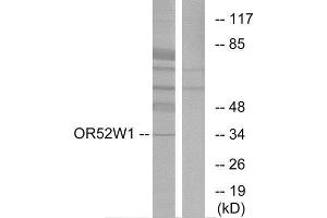 Western Blotting (WB) image for anti-Olfactory Receptor, Family 52, Subfamily W, Member 1 (OR52W1) (C-Term) antibody (ABIN1853147) (OR52W1 anticorps  (C-Term))