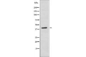 Western blot analysis of extracts from HeLa cells, using 5-HT-5A antibody. (Serotonin Receptor 5A anticorps  (Internal Region))