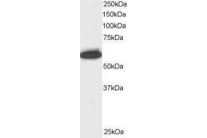 Western Blotting (WB) image for anti-Nucleoporin 50kDa (NUP50) antibody (ABIN5872779) (NUP50 anticorps)