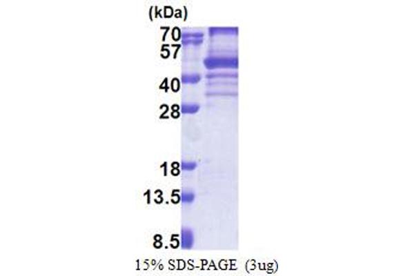 EBNA1BP2 Protein (AA 1-306) (His tag)