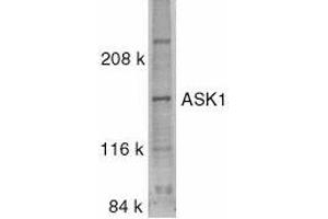 Western blot analysis of ASK1 in SW1353 whole cell lysate with ASK1 antibody at 0. (ASK1 anticorps)