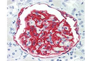 Human Kidney: Formalin-Fixed, Paraffin-Embedded (FFPE) (PODXL anticorps)