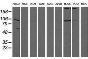 Western blot analysis of extracts (35 µg) from 9 different cell lines by using anti-ALDH1L1 monoclonal antibody. (ALDH1L1 anticorps)