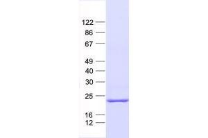 Validation with Western Blot (NHP2 Protein (His tag))