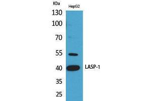 Western Blotting (WB) image for anti-LIM and SH3 Protein 1 (LASP1) (Internal Region) antibody (ABIN6286973) (LASP1 anticorps  (Internal Region))