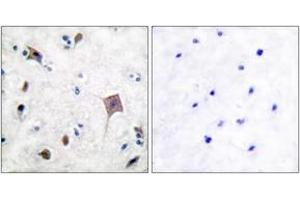 Immunohistochemistry analysis of paraffin-embedded human brain tissue, using PYK2 (Ab-580) Antibody. (PTK2B anticorps  (AA 546-595))