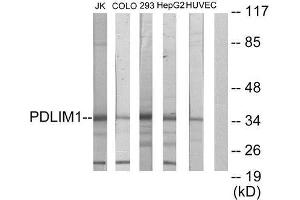 Western Blotting (WB) image for anti-PDZ and LIM Domain 1 (PDLIM1) (Internal Region) antibody (ABIN1848910) (PDLIM1 anticorps  (Internal Region))